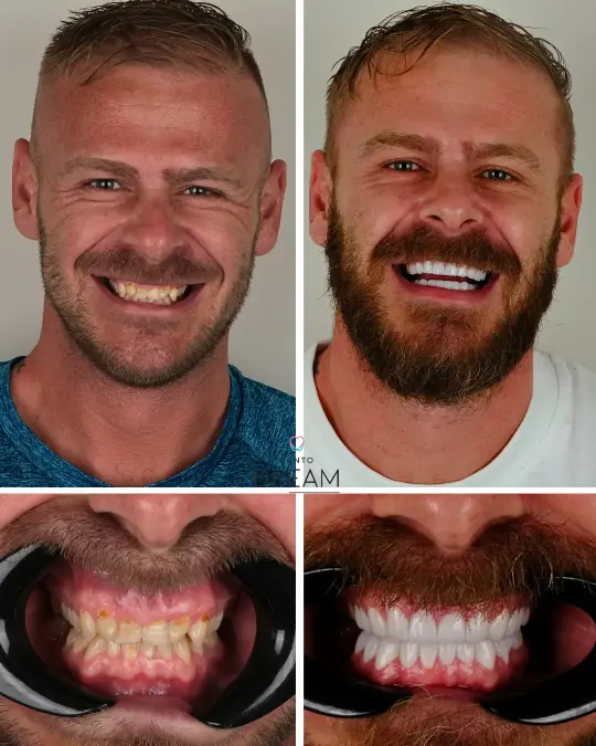 Before and after dental smile case 27