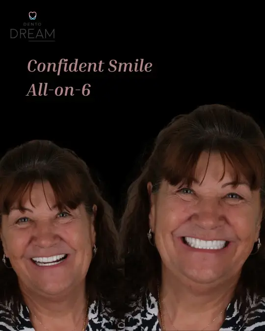 Dento Dream Konyaaltı