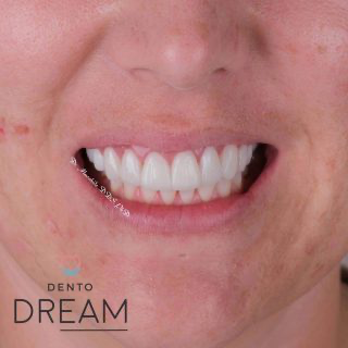 Samantha from UK review