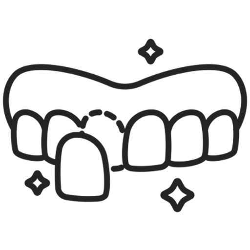 Dental Veneers